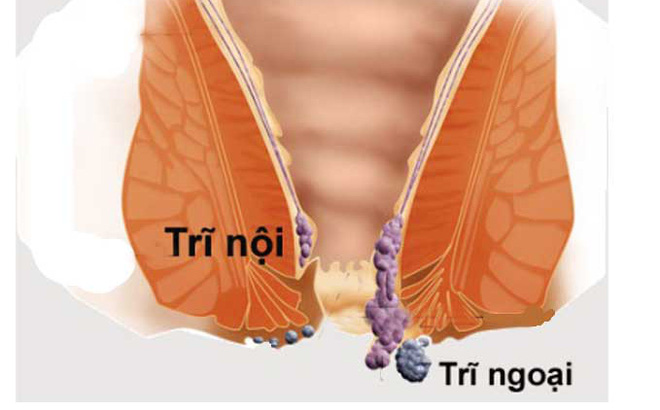 phuong phap dieu tri benh tri tai nha